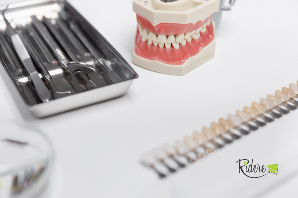 Implant dentar la clinica Ridere Suceava: ce ar trebui să știi înainte să începi tratament