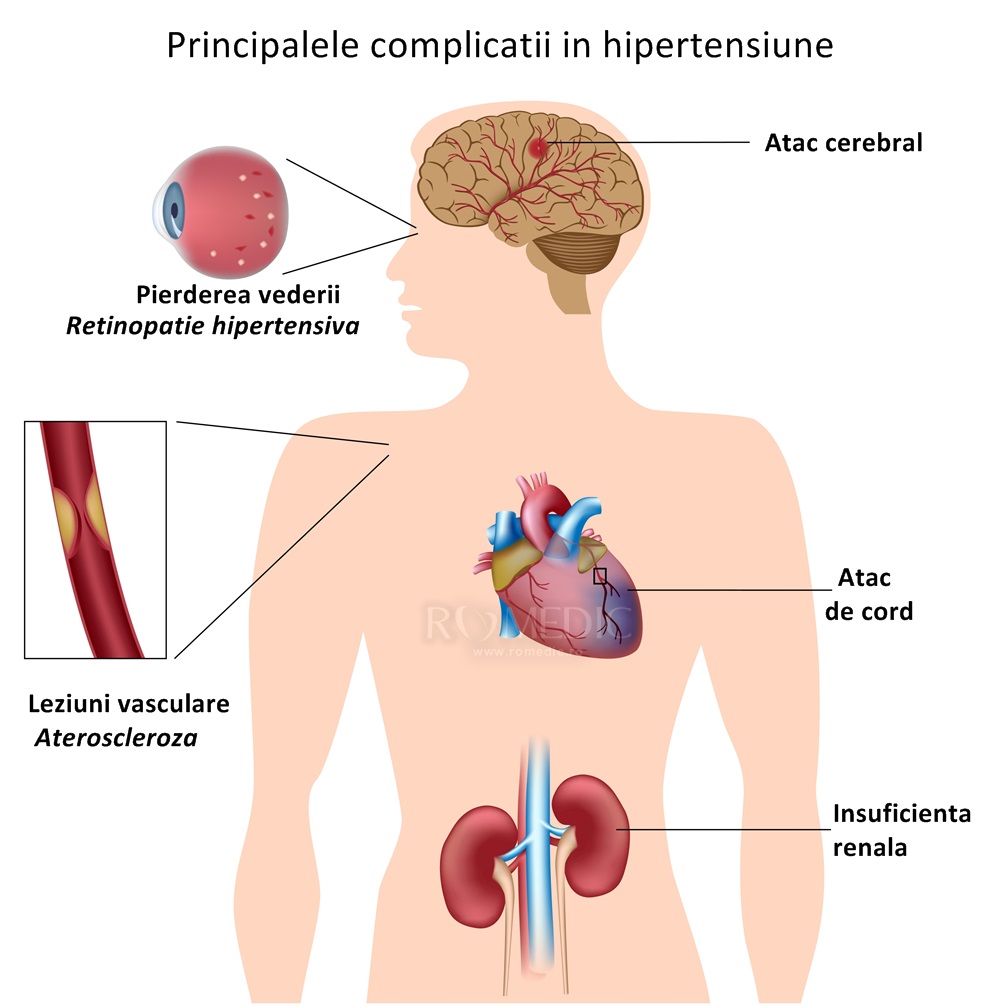 erectie prostanormala