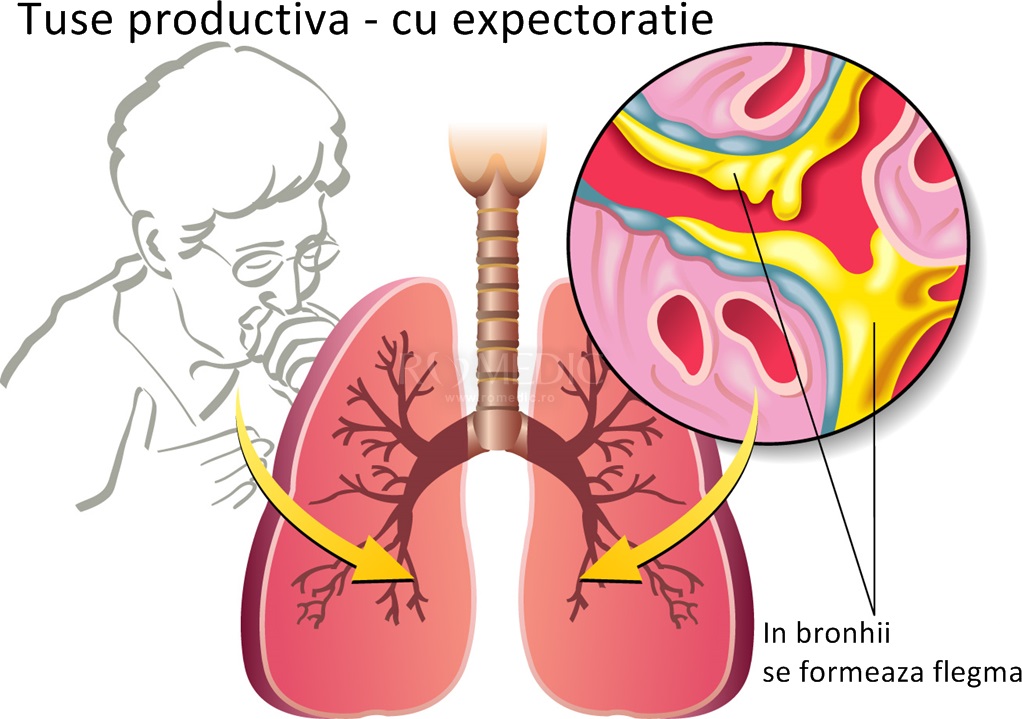 inflamarea tusei a articulației