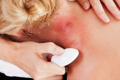 Terapia Gua Sha