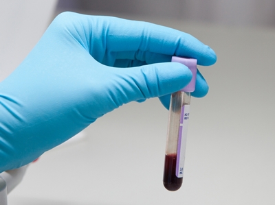 Un hidrogel antihemoragic rapid cu venin de șarpe