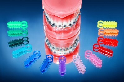 Componentele unui aparat dentar și rolul acestora