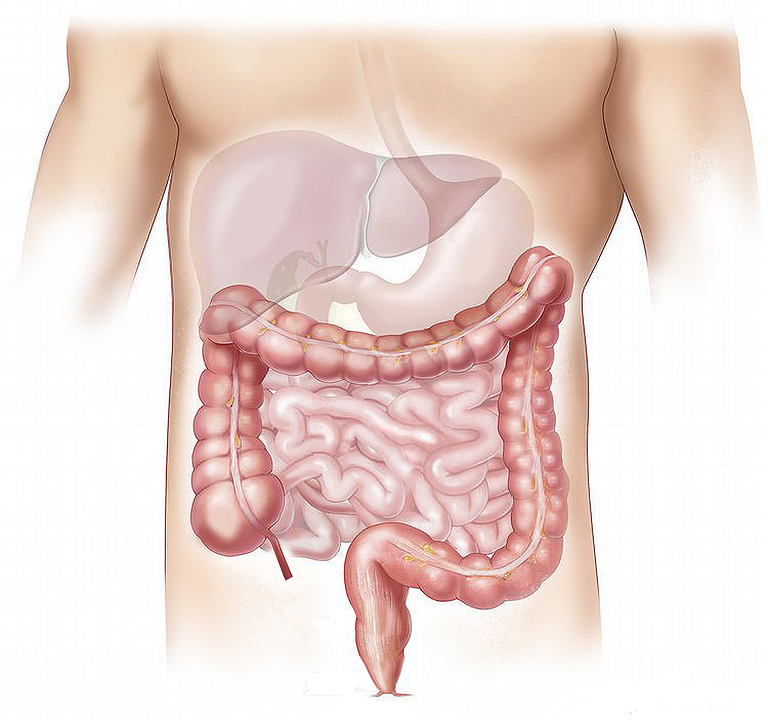 cât de des trebuie să- ți detoxifiezi colonul)