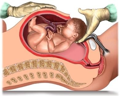 modula determina simptomele prostatitei efecte secundare dupa operatia de prostata