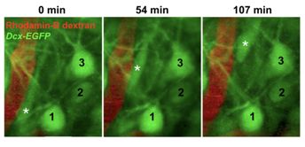 Descoperirea mecanismelor migrației neuronale în creierul adultului