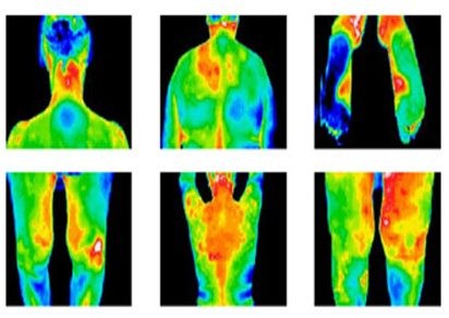 Termografia