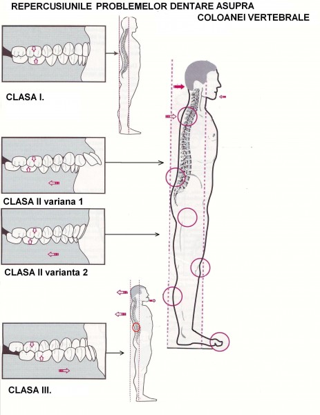 analiza din coloana vertebrala